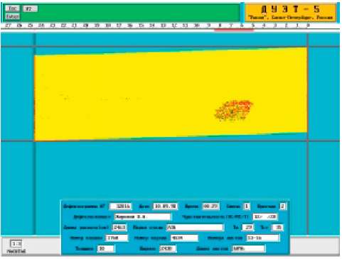 Экран рабочей станции в режиме подробного анализа дефектограммы раската